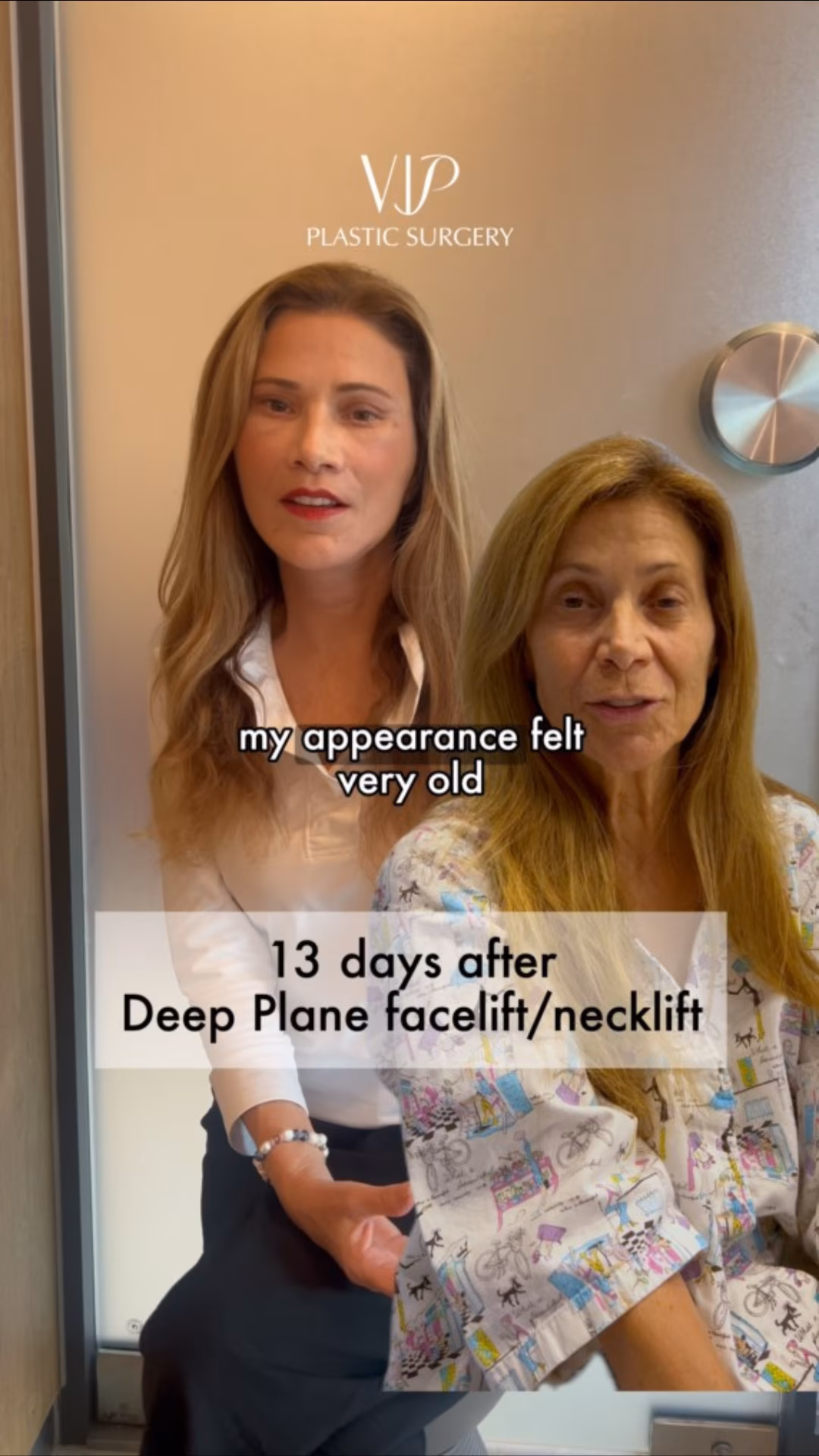 2 Weeks Post-op Female Extended Deep Plane Facelift and Necklift Video